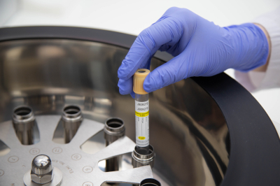 Гематолог Никитин объяснил, кому и когда нужно сдавать общий анализ крови